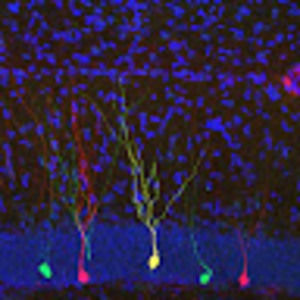 Meet your Posher, Patrick